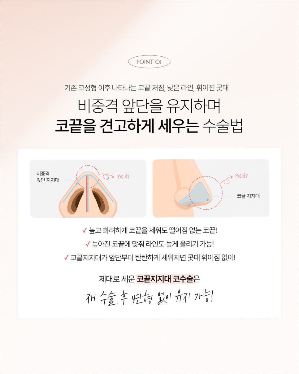 비주빼기,자려한 코 성형을 고려 중이신 분들 꼭 확인해 보세요. 관련 이미지 2