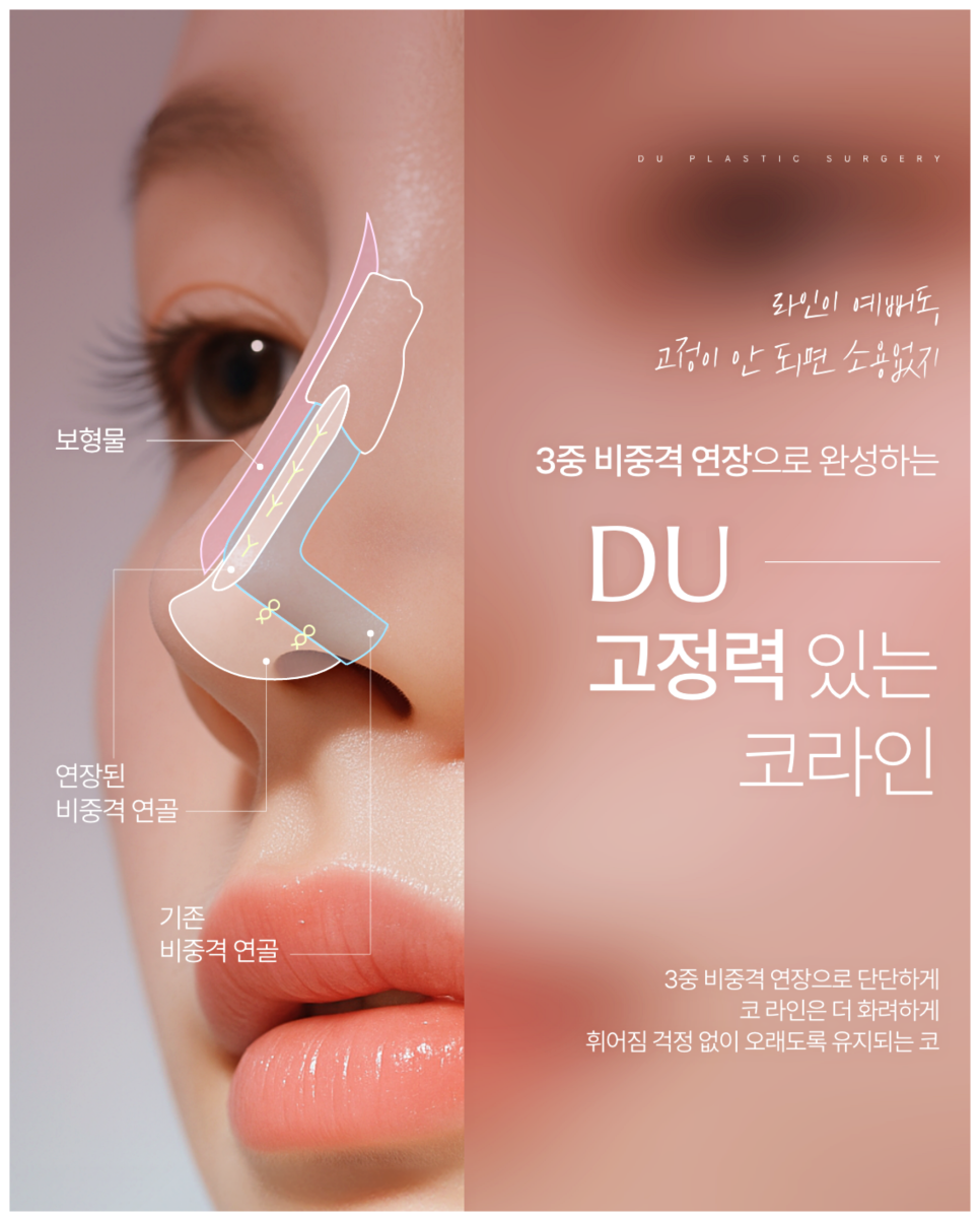 Male Nose Filler Side Effects: When Is Surgery Necessary? image 2