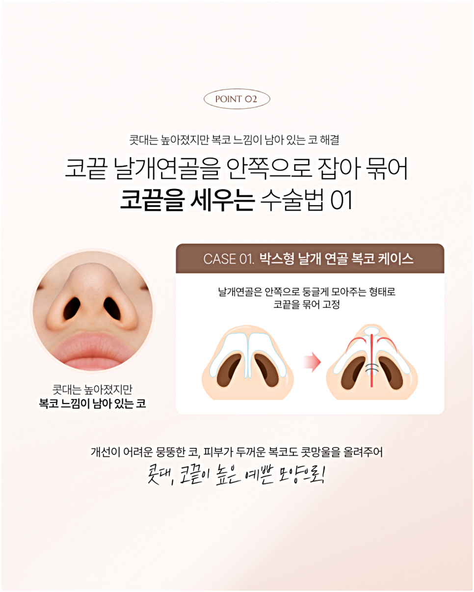 코재건 다시 또 수술하지 않으려면 꼭 알아야 할 한 가지 관련 이미지 4