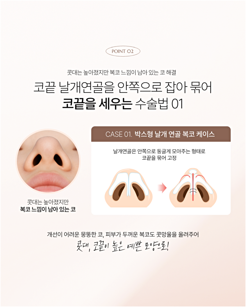 늑연골코수술부작용이 걱정되시는 분들은 읽어보세요 관련 이미지 3