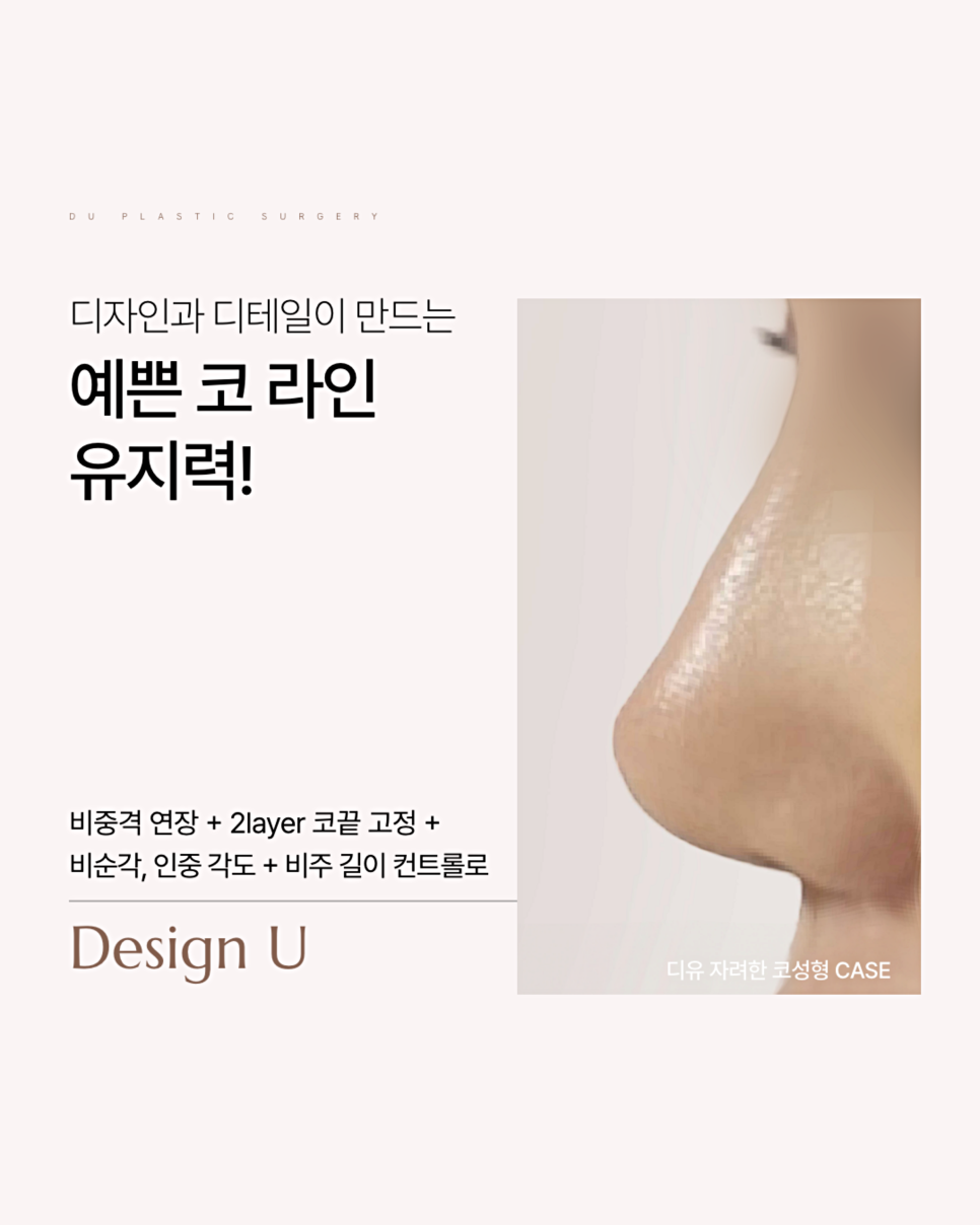 Male Nose Filler Side Effects: When Is Surgery Necessary? image 8