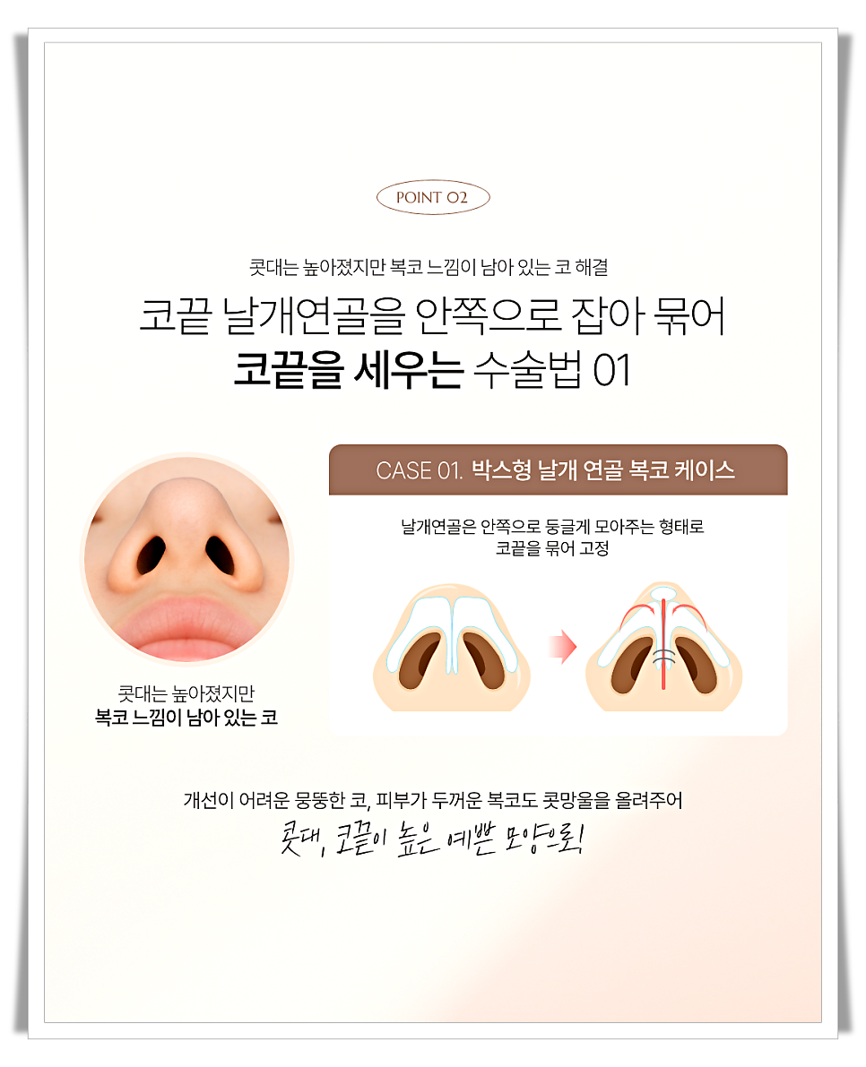 코끝처짐 원인과 교정 방법 관련 이미지 7