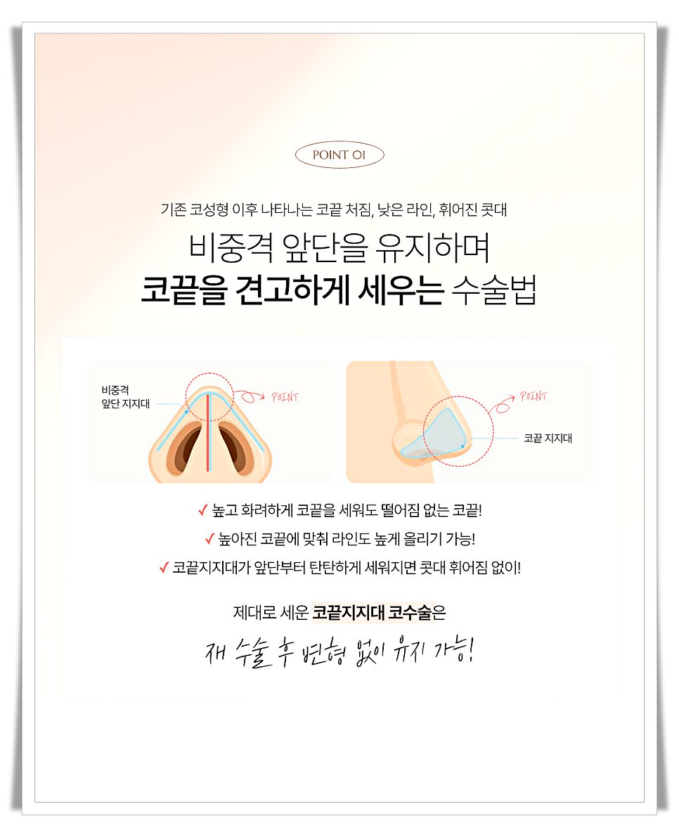 코끝처짐 원인과 교정 방법 관련 이미지 4