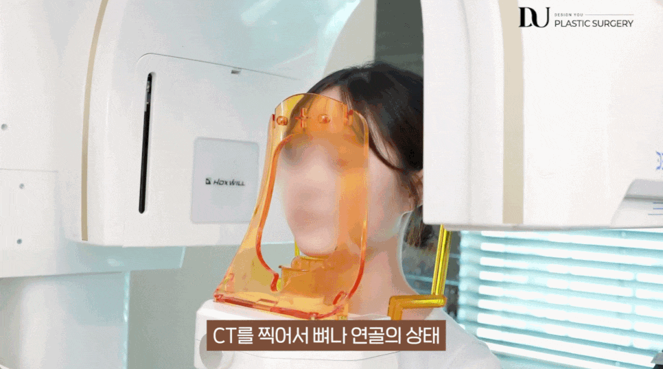 Seoul facelift results vary depending on where you get the procedure. image 8