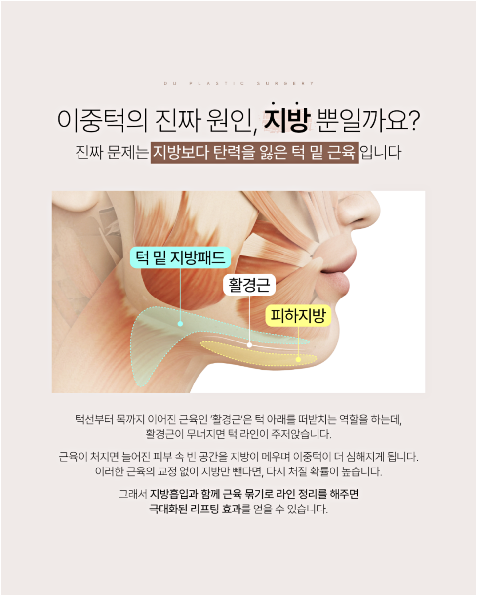 If you're worried about swelling after double chin muscle tightening, read this image 5