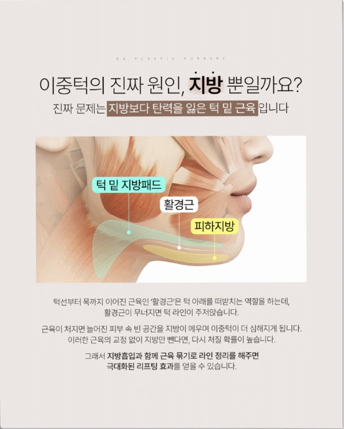 투턱 수술,이중턱 성형의 얼굴 윤곽 개선 효과 관련 이미지 1