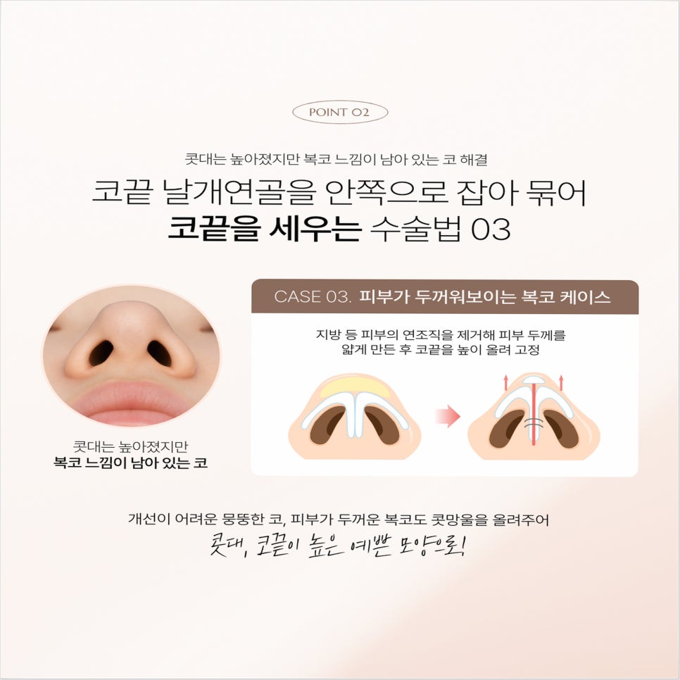 Autologous Cartilage Nose Surgery: The Real Reason Choosing a Plastic Surgery Clinic Determines the Outcome image 6