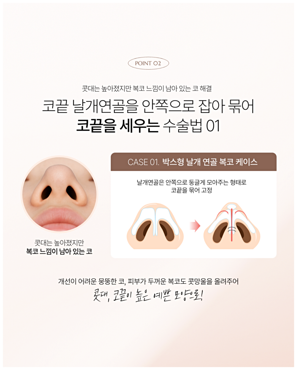 Male Nose Filler Side Effects: When Is Surgery Necessary? image 6