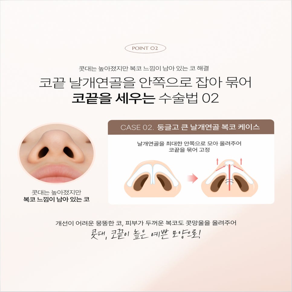 Autologous Cartilage Nose Surgery: The Real Reason Choosing a Plastic Surgery Clinic Determines the Outcome image 5