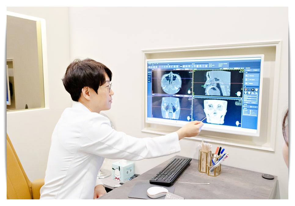 How to Prevent Nasal Tip Drooping image 1