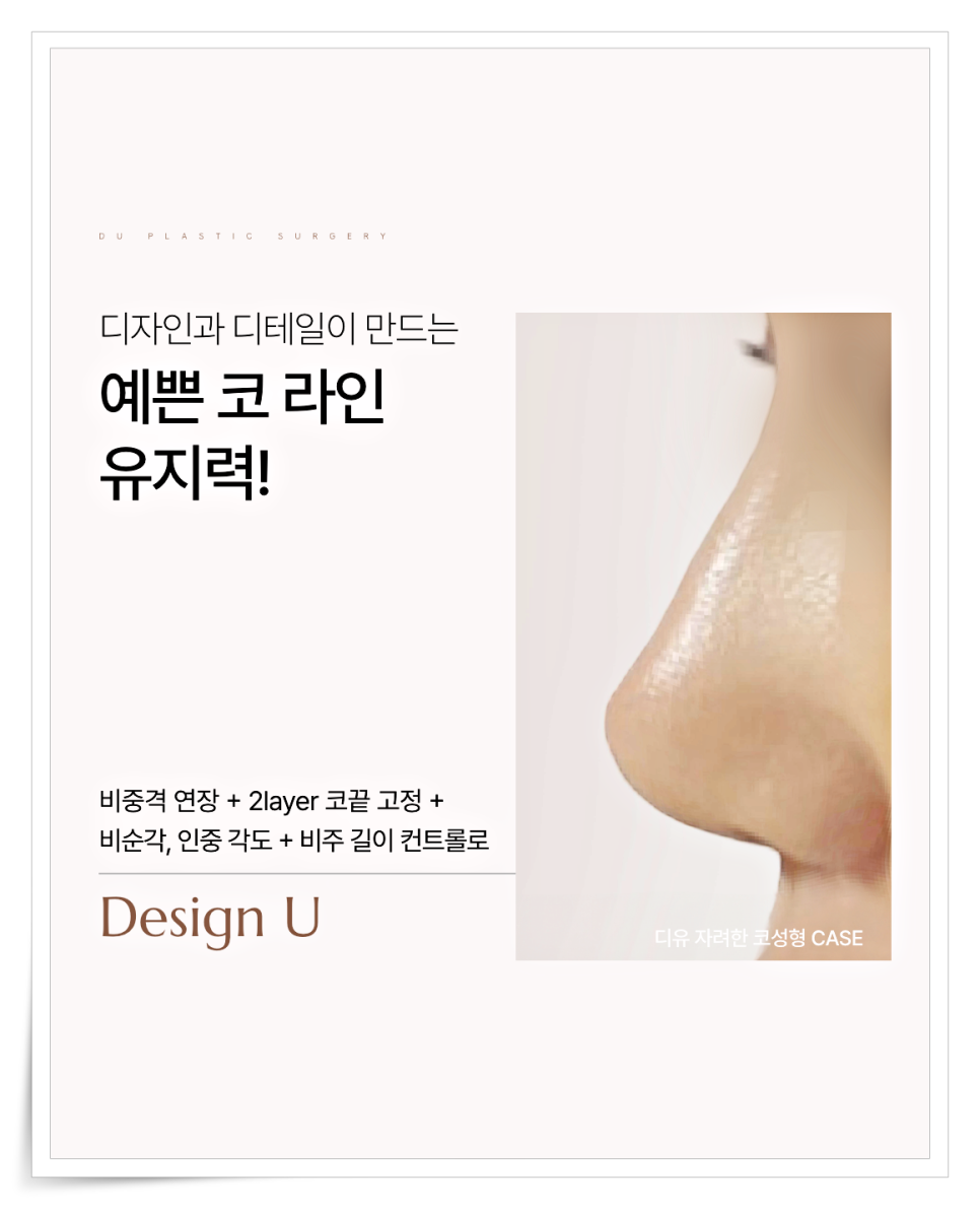 짧은코 재수술, 해결하려면 구조부터 봐야 합니다 관련 이미지 5