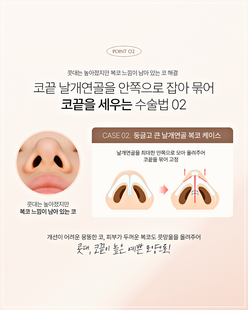 코끝필러퍼짐, 왜 생기고 어떻게 해결할까? 관련 이미지 6