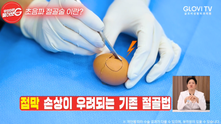 압구정역성형외과 코성형, 초음파절골술로 안전하게 관련 이미지 8