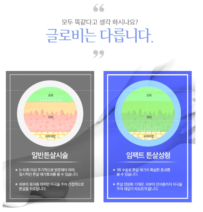 튼살치료 임팩트튼살성형으로! 관련 이미지 2