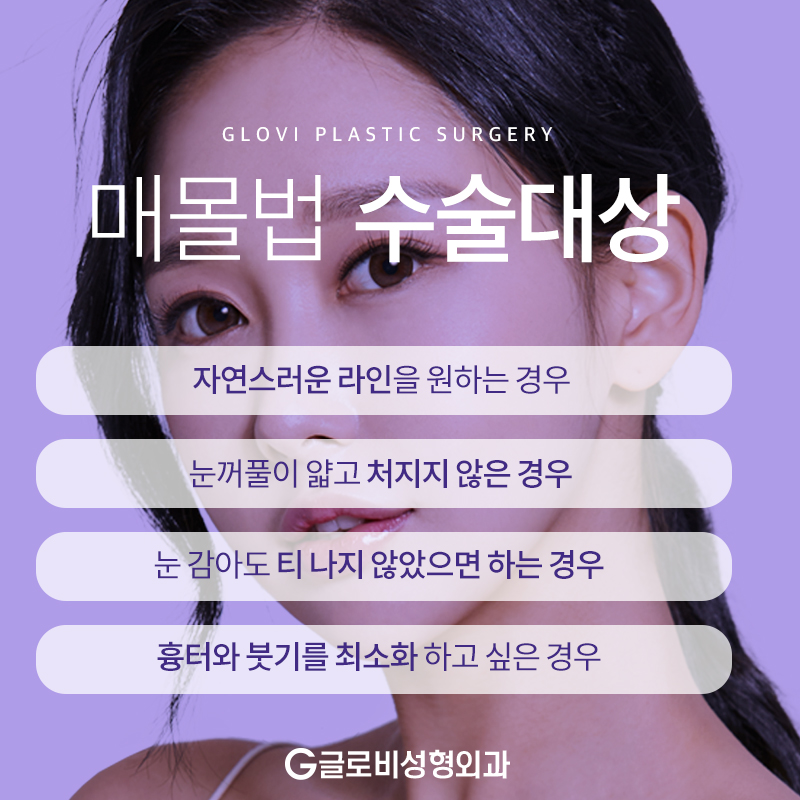 쌍꺼풀매몰법 자연스럽게 관련 이미지 2