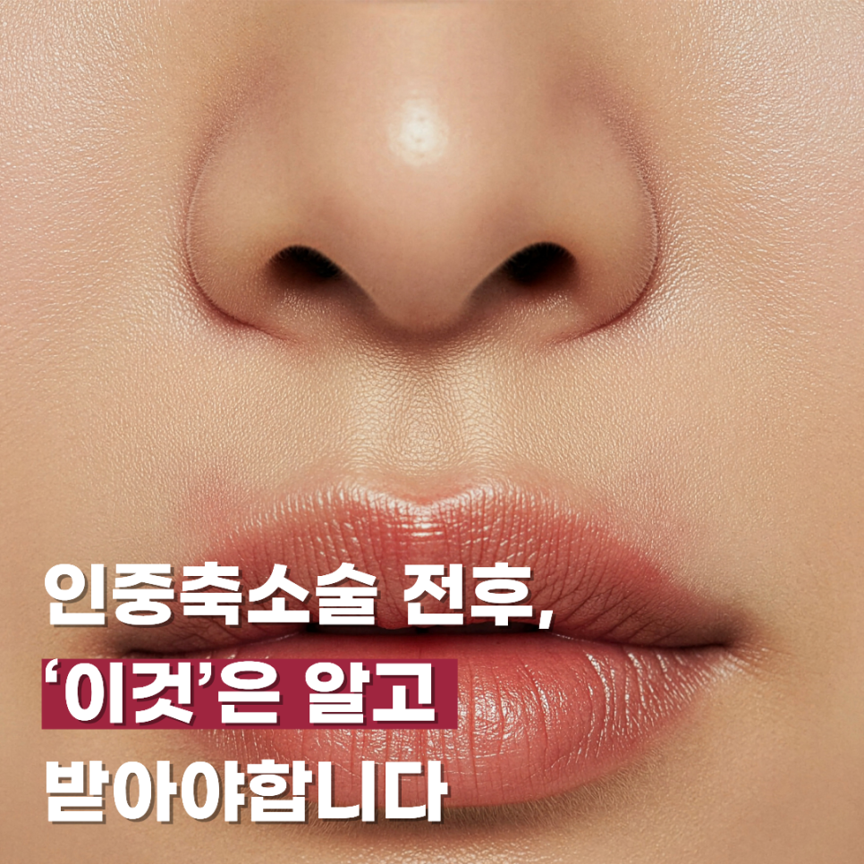 인중축소술 전후, &lsquo;이것&rsquo;은 알고 받아야합니다 관련 이미지 1