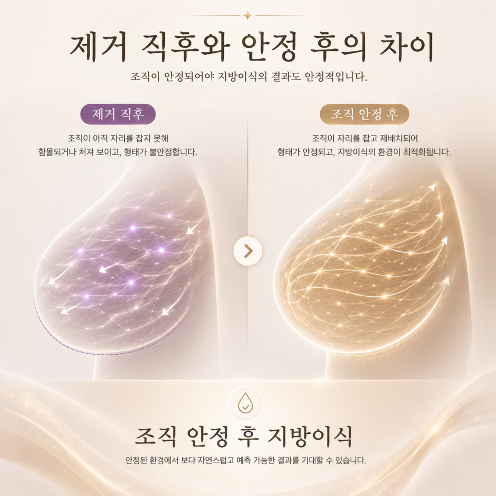 What to Check Before Consulting About Fat Grafting After Breast Implant Removal image 3