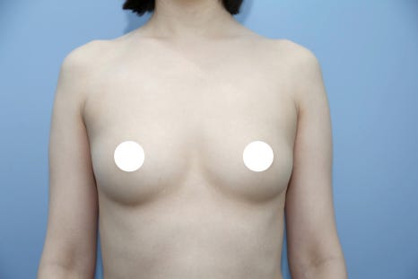 Pain After Breast Surgery May Be a Warning Sign Your Body Should Not Ignore image 6