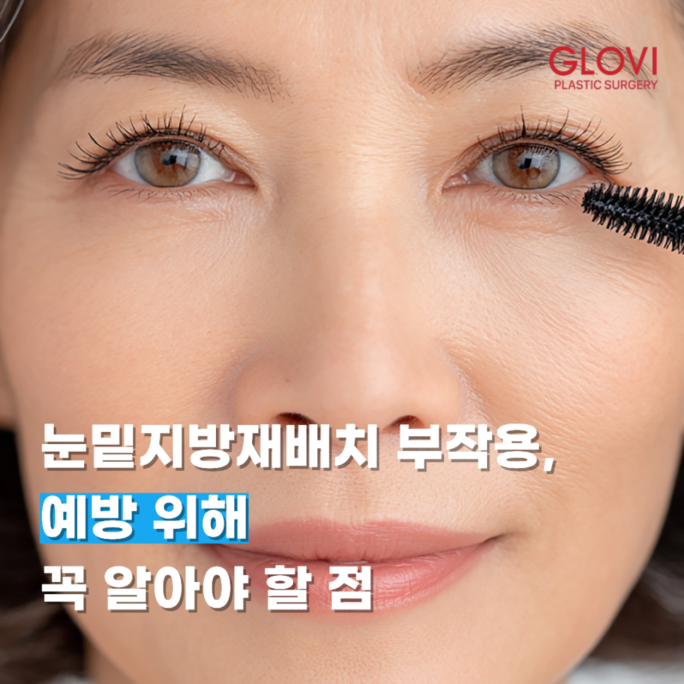 Lower Eyelid Fat Repositioning Side Effects: What You Should Know to Help Prevent Them image 1