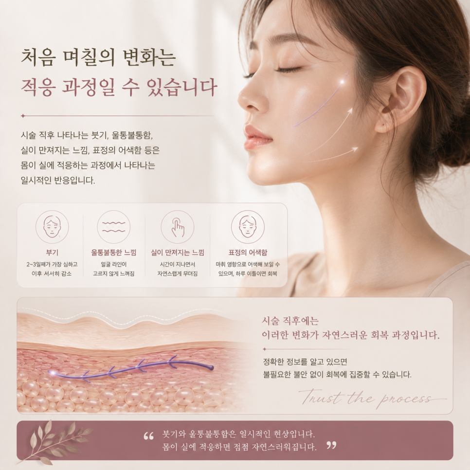 Thread-Lifting Side Effects: Changes That May Occur After the Procedure image 2