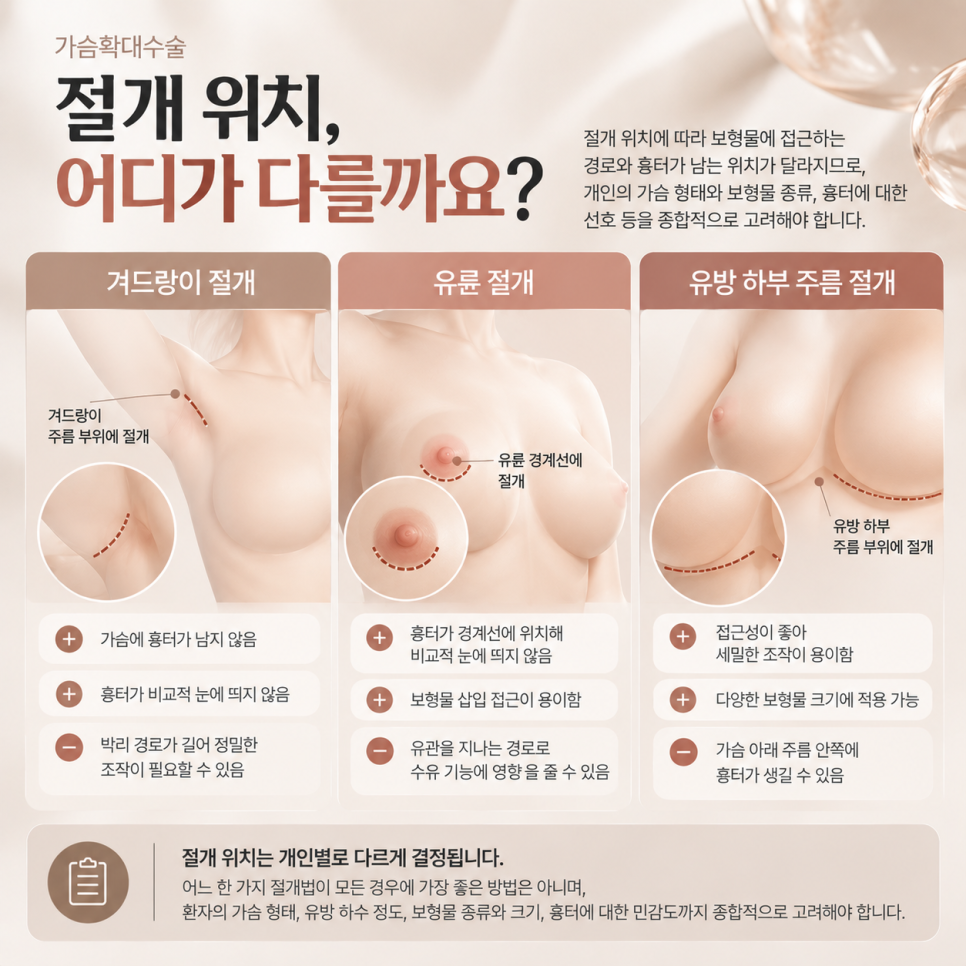 가슴확대수술, "어디서 해야 하나"보다 먼저 알아야 할 것들 관련 이미지 5