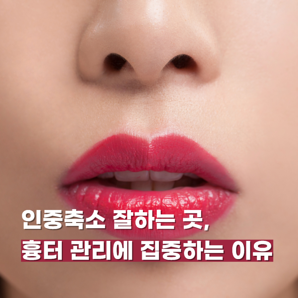 인중축소 잘하는 곳, 흉터 관리에 집중하는 이유 관련 이미지 1