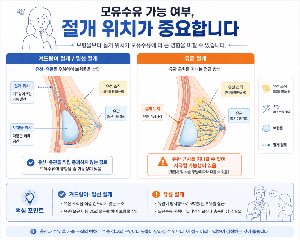 가슴수술 후 모유수유, 출산 계획 있다면 이것부터 확인하세요 관련 이미지 2