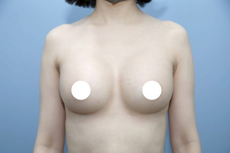 Pain After Breast Surgery May Be a Warning Sign Your Body Should Not Ignore image 7