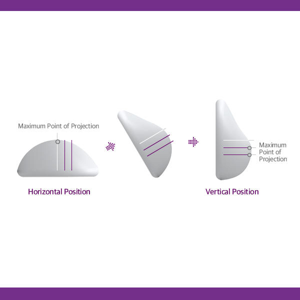 모티바가슴성형 보형물에 대해 알아보자 관련 이미지 3