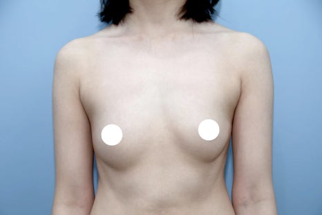 Pain After Breast Surgery May Be a Warning Sign Your Body Should Not Ignore image 4