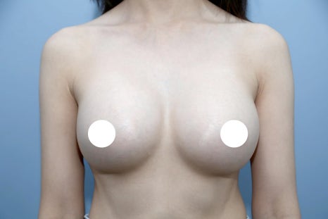 Pain After Breast Surgery May Be a Warning Sign Your Body Should Not Ignore image 5