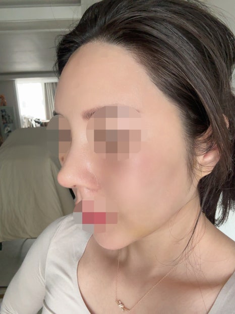 실리프팅 후 관리법, 효과를 오래 유지하는 습관 관련 이미지 3