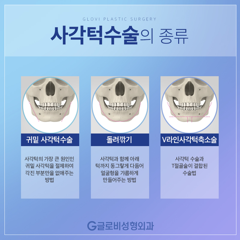 안면윤곽수술 이상적인 얼굴형 관련 이미지 4