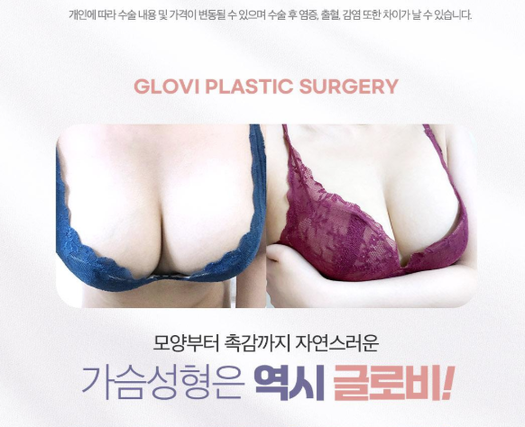 보형물삽입과 가슴지방이식 성형고민 해결해드려요! 관련 이미지 1