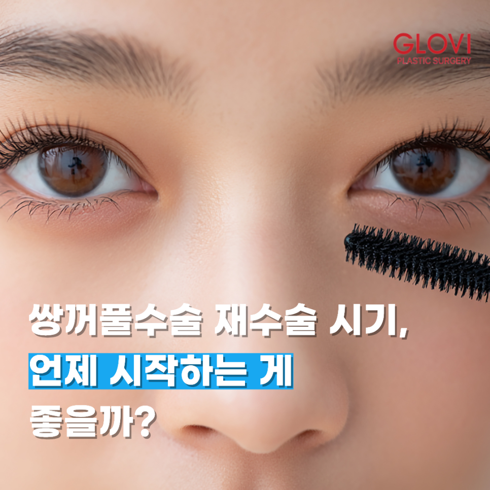 쌍꺼풀수술 재수술 시기, 언제 시작하는 게 좋을까? 관련 이미지 1