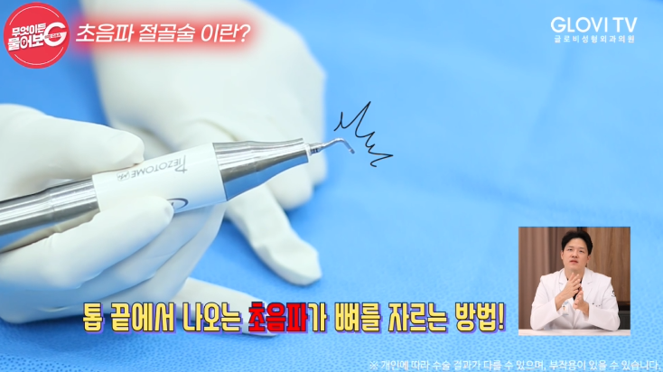 압구정역성형외과 코성형, 초음파절골술로 안전하게 관련 이미지 12