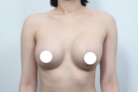 Pain After Breast Surgery May Be a Warning Sign Your Body Should Not Ignore image 3