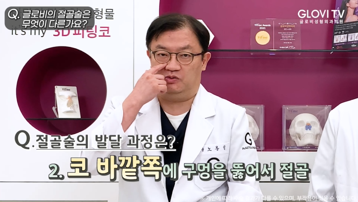 코성형 절골술, 재발률을 낮춘 새로운 방법 | 인터뷰 (1탄) 관련 이미지 14