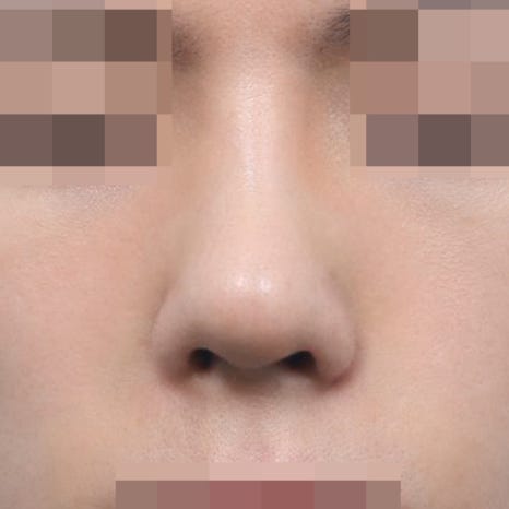 남자 코성형 여성과 확연히 다른 디자인 포인트 관련 이미지 6