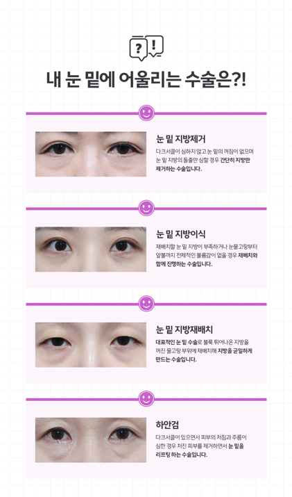 눈밑지방재배치수술 눈밑지란? 눈밑지 붓기 부작용은? 관련 이미지 4