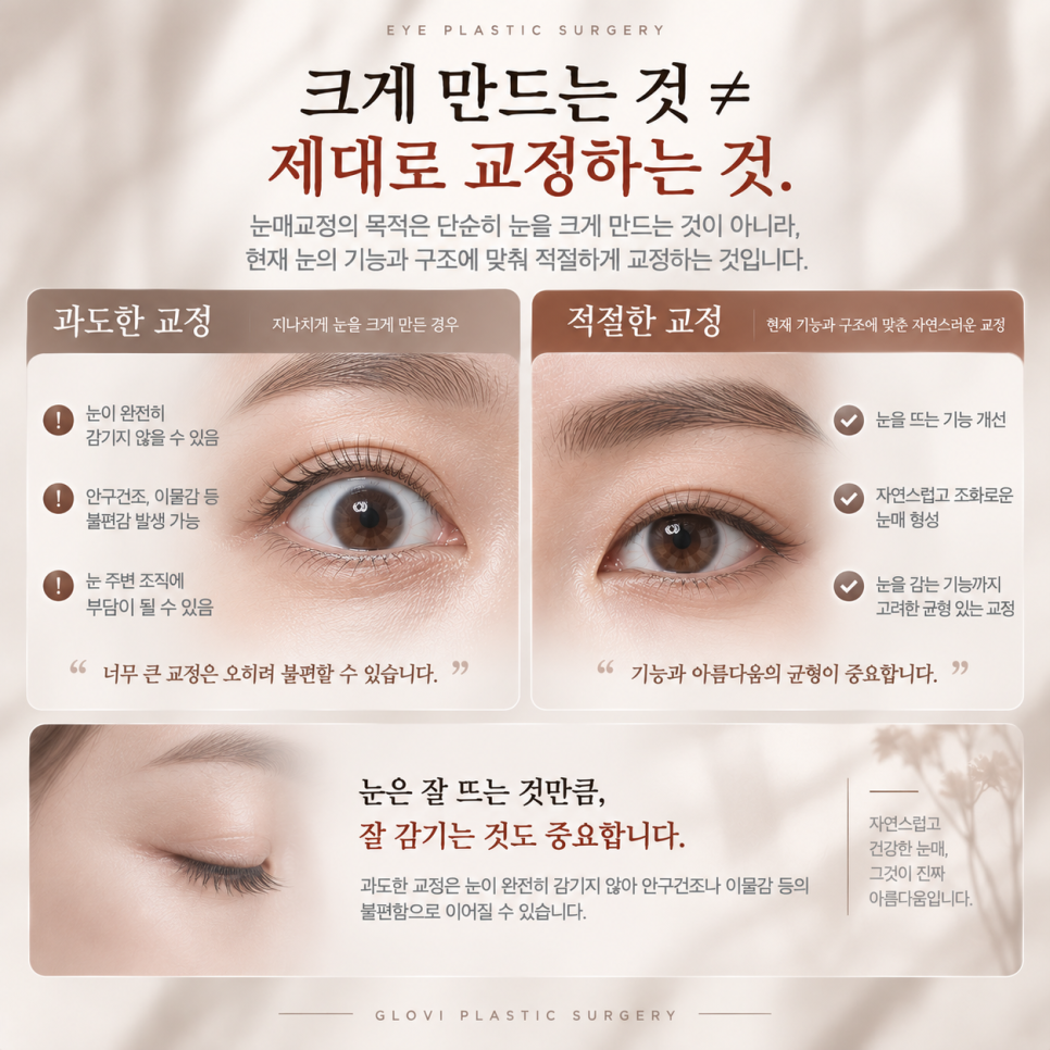 중년 눈꺼풀처짐, 눈매교정만 하면 될까요? 알아야 할 한 가지 관련 이미지 5