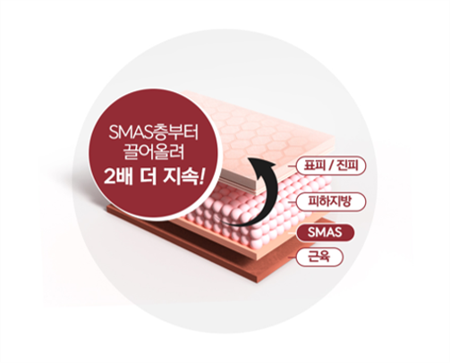 압구정 실리프팅, 3개월 만에 풀렸다면? 관련 이미지 3