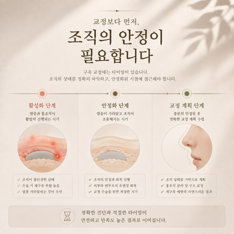 구축코수술 코가 딱딱해졌다면 먼저 확인할 변화는 무엇일까? 관련 이미지 7