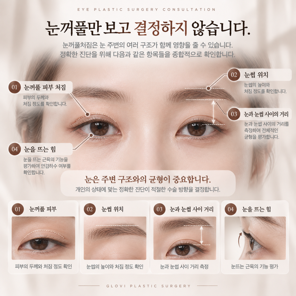 중년 눈꺼풀처짐, 눈매교정만 하면 될까요? 알아야 할 한 가지 관련 이미지 3