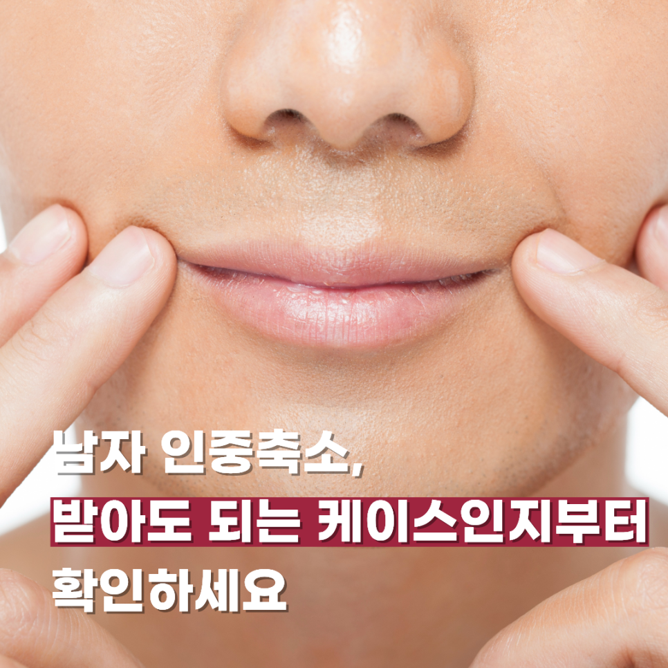 남자 인중축소, 받아도 되는 케이스인지부터 확인하세요 관련 이미지 1