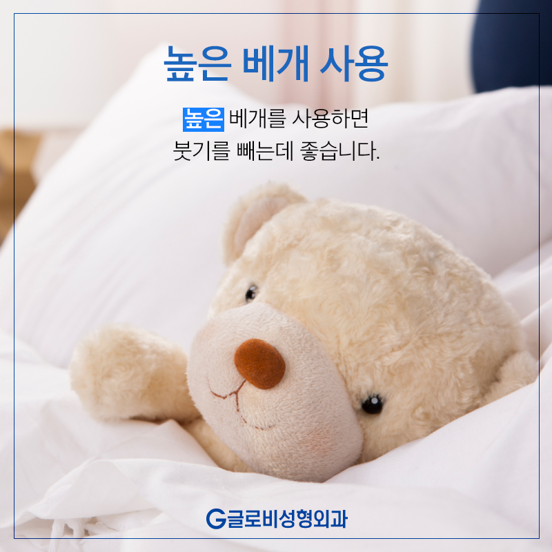 성형수술 후 붓기 빨리 빼는 방법 관련 이미지 3