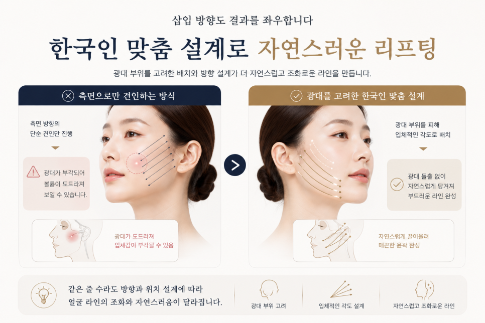 실리프팅 몇 줄이 적당한지 고민이라면 클릭 관련 이미지 10