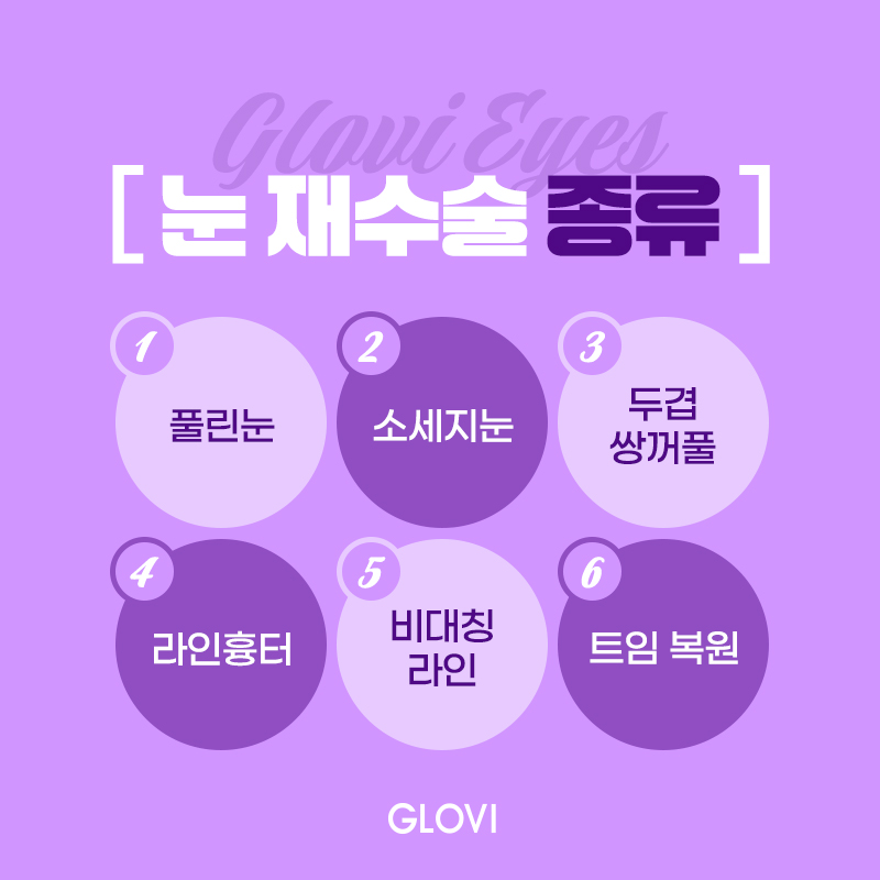 쌍꺼풀재수술잘하는병원 선택 전 주의사항 관련 이미지 2