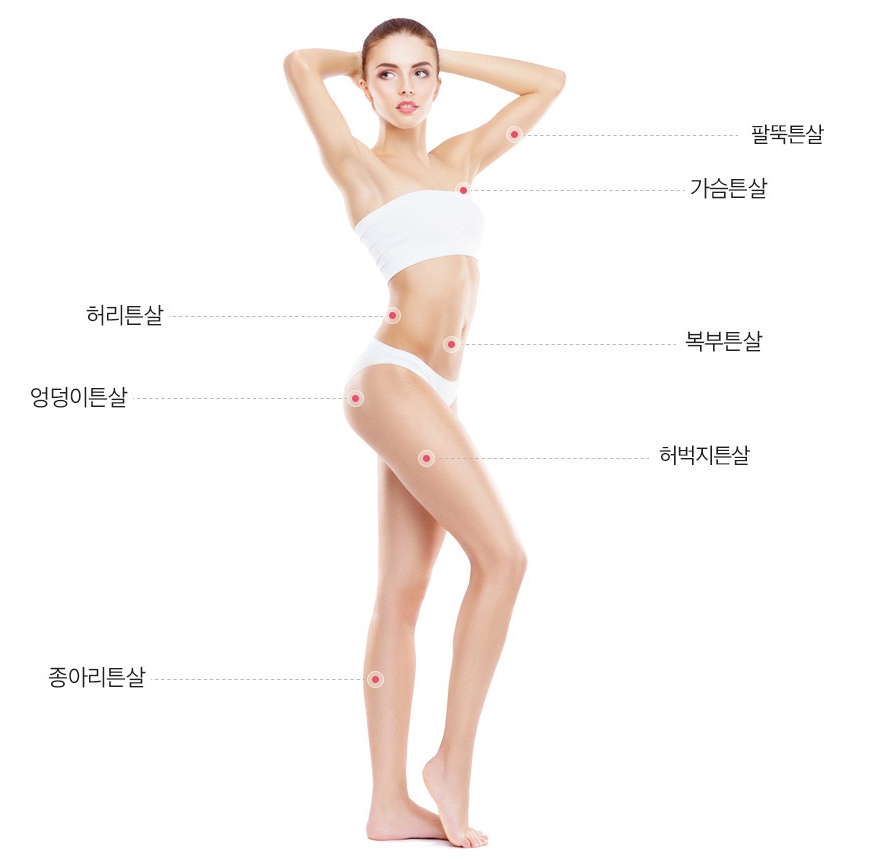 튼살치료 임팩트튼살성형으로! 관련 이미지 3