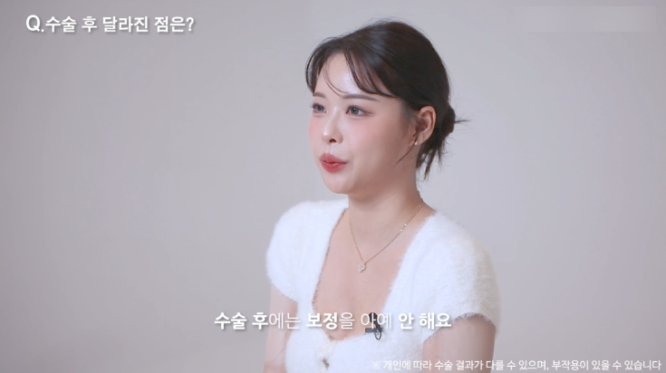 눈밑지방재배치수술 리얼후기 2탄｜수술 한달 후 경과확인! 관련 이미지 8